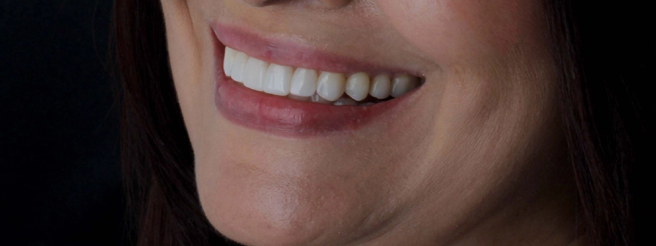 Cuidados para los implantes dentales