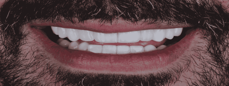 Implantes dentales en Medellín-caso-clínico-Jonathan-paciente