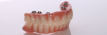 implantes-dentales-medellin-protesis-sobre-implantes