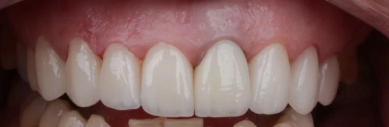 odontologia-estetica